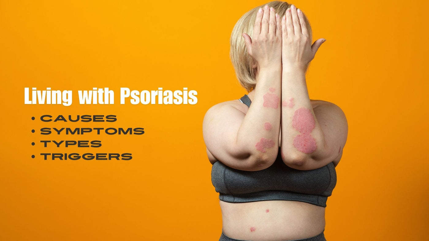 Psoriasis, Psoriasis Causes, Psoriasis Types, Psoriasis Triggers
